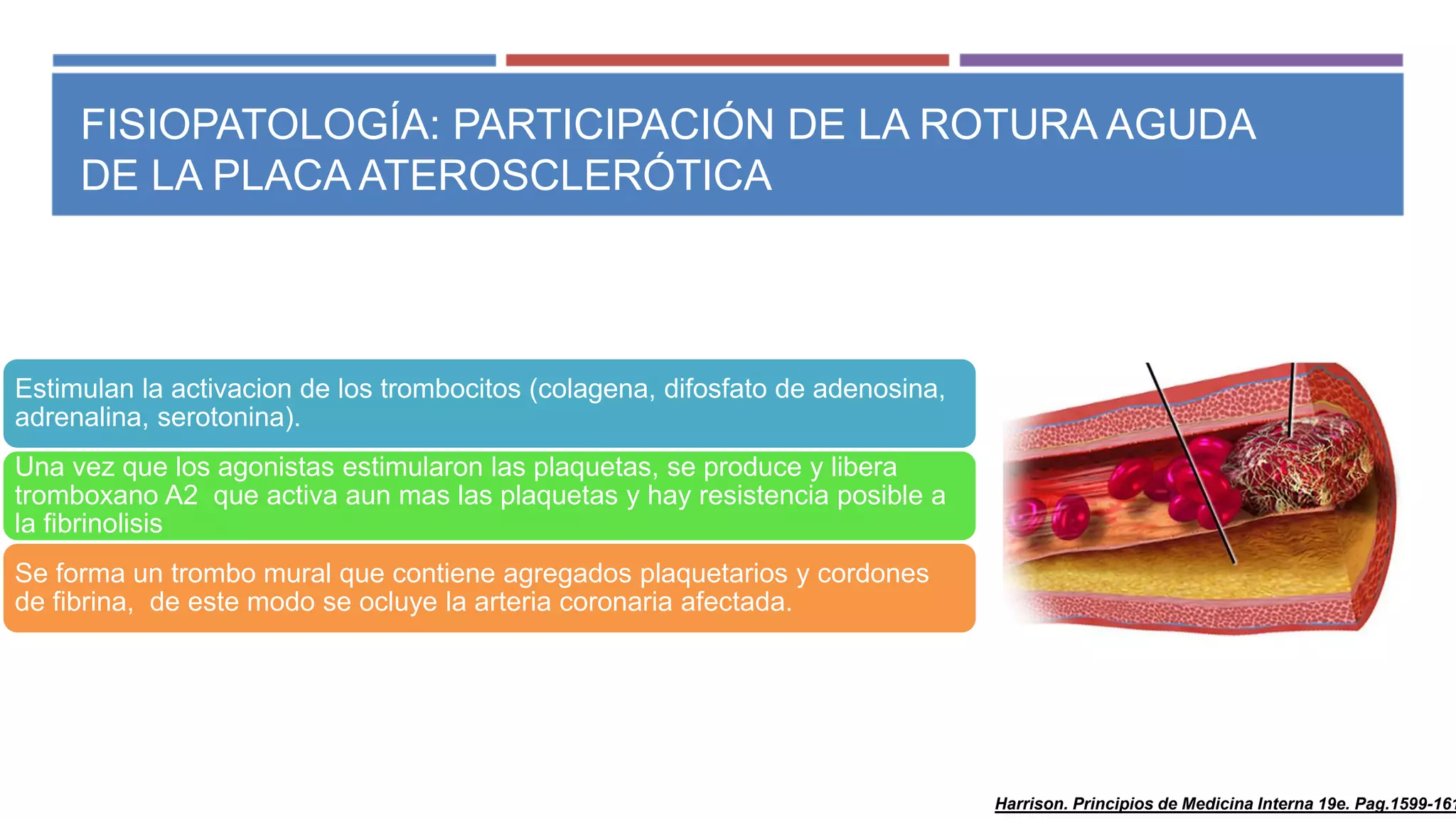 Infarto agudo al miocardio con elevacion del segmento st | PPT