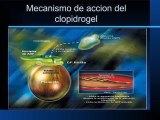 Mecanismo de accion del
clopidrogel
 