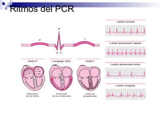 Ritmos del PCR 