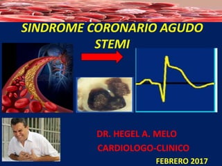SINDROME CORONARIO AGUDO
STEMI
DR. HEGEL A. MELO
CARDIOLOGO-CLINICO
FEBRERO 2017
 