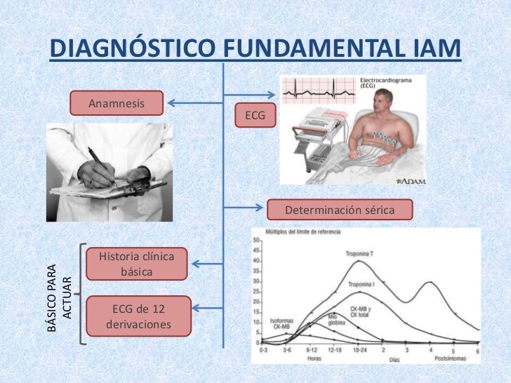 La Vida es Así (II) - El Infarto, la Angina, los Síndromes Coronarios Agudos - Tema serio