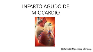 INFARTO AGUDO DE
MIOCARDIO
Stefanía Liz Menéndez Mendoza
 