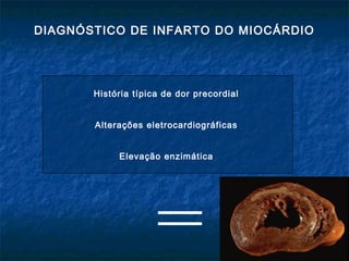 DIAGNÓSTICO DE INFARTO DO MIOCÁRDIO
História típica de dor precordial
Alterações eletrocardiográficas
Elevação enzimática
 