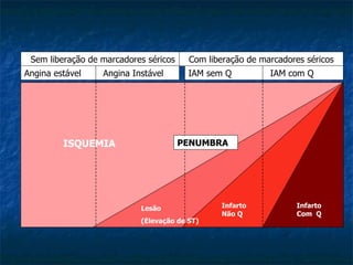 Sem liberação de marcadores séricos Com liberação de marcadores séricos Angina estável  Angina Instável IAM sem Q  IAM com Q PENUMBRA Infarto Não Q Infarto Com  Q Lesão (Elevação de ST) ISQUEMIA 