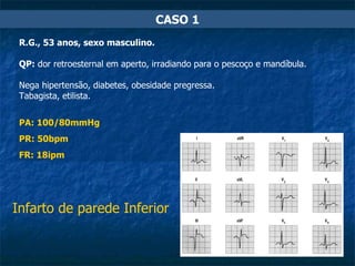 CASO 1 R.G., 53 anos, sexo masculino. QP:  dor retroesternal em aperto, irradiando para o pescoço e mandíbula.  Nega hipertensão, diabetes, obesidade pregressa. Tabagista, etilista. PA: 100/80mmHg PR: 50bpm FR: 18ipm Infarto de parede Inferior 