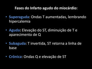 Fases do Infarto agudo do miocárdio:
• Superaguda: Ondas T aumentadas, lembrando
hipercalemia
• Aguda: Elevação do ST, diminuição de T e
aparecimento de Q
• Subaguda: T invertida, ST retorna a linha de
base
• Crônica: Ondas Q e elevação de ST
 