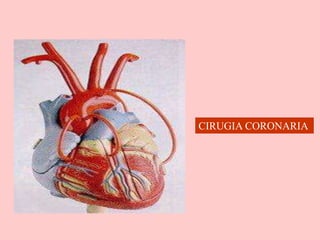 CIRUGIA CORONARIA
 