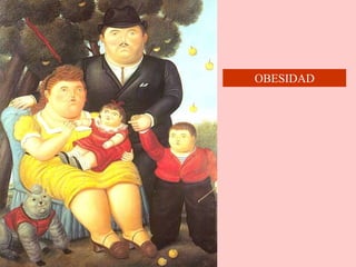 OBESIDAD
 