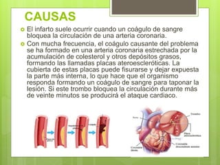 CAUSAS
 El infarto suele ocurrir cuando un coágulo de sangre
bloquea la circulación de una arteria coronaria.
 Con mucha frecuencia, el coágulo causante del problema
se ha formado en una arteria coronaria estrechada por la
acumulación de colesterol y otros depósitos grasos,
formando las llamadas placas ateroescleróticas. La
cubierta de estas placas puede fisurarse y dejar expuesta
la parte más interna, lo que hace que el organismo
responda formando un coágulo de sangre para taponar la
lesión. Si este trombo bloquea la circulación durante más
de veinte minutos se producirá el ataque cardiaco.
 