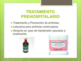 TRATAMIENTO
PREHOSPITALARIO
 Tratamiento y Prevención de arritmias:
 Lidocaína para arritmias ventriculares.
 Atropina en caso de hipotensión asociado a
bradicardia.
 