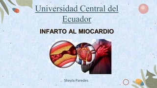 Universidad Central del
Ecuador
INFARTO AL MIOCARDIO
Sheyla Paredes
 