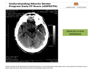 Comprehensive Overview of Cerebral Infarction: Classification ...