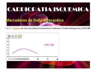 CARDIOPATIA ISQUEMICA
Marcadores de Daño Miocardico
 