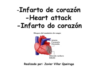 - Infarto de corazón   -Heart attack -Infarto do corazón Realizado por: Javier Villar Queiruga 