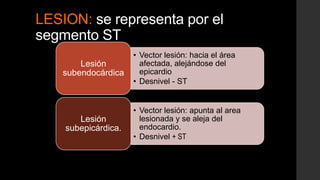LESION: se representa por el
segmento ST
• Vector lesión: hacia el área
afectada, alejándose del
epicardio
• Desnivel - ST
Lesión
subendocárdica
• Vector lesión: apunta al area
lesionada y se aleja del
endocardio.
• Desnivel + ST
Lesión
subepicárdica.
 
