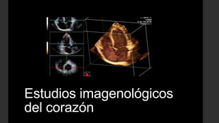 Estudios imagenológicos
del corazón
 