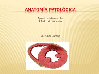 ANATOMÍA PATOLÓGICA 
Aparato cardiovascular 
Infarto del miocardio 
Dr. Yuniel Camejo 
 