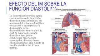 EFECTO DEL IM SOBRE LA 
FUNCIÓN DIASTÓLICA: 
La isquemia miocárdica aguda 
causa aumento de la presión 
diastólica intraventrícular, sin 
aumento del volumen diastólico 
(relajación e incompleta y/o 
disminución de la 
distensibilidad ventricular), lo 
cual da lugar a disfunción 
diastólica, que puede 
condicionar hipertensión 
venocapilar, disnea y hasta 
edema pulmonar, aun cuando la 
función sistólica del VI sea 
normal. 
 