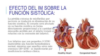 EFECTO DEL IM SOBRE LA 
FUNCIÓN SISTÓLICA: 
La pérdida extensa de miofibrillas por 
necrosis se traducirá en disminución de su 
función sistólica. El corazón será afectado 
en su función sistólica en forma 
directamente proporcional a la cantidad de 
miocardio perdido por el infarto (estará en 
relación con la extensión del infarto). 
Los infartos que son pequeños (<15%) 
mantendrán una función hemodinámica 
normal, mientras que aquellos otros más 
extensos (20-25%) se manifestarán por 
insuficiencia cardiaca clínica. 
 