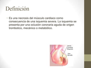 Definición
• Es una necrosis del músculo cardiaco como
consecuencia de una isquemia severa. La isquemia se
presenta por una oclusión coronaria aguda de origen
trombotico, mecánico o metabólico.
 