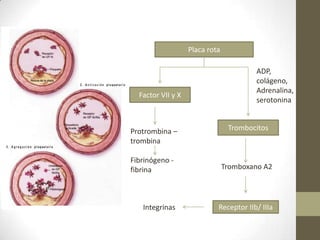 Placa rota
Trombocitos
Factor VII y X
ADP,
colágeno,
Adrenalina,
serotonina
Tromboxano A2
Protrombina –
trombina
Fibrinógeno -
fibrina
Receptor IIb/ IIIaIntegrinas
 