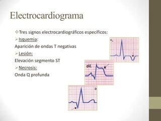 Electrocardiograma
Tres signos electrocardiográficos específicos:
Isquemia:
Aparición de ondas T negativas
Lesión:
Elevación segmento ST
Necrosis:
Onda Q profunda
 
