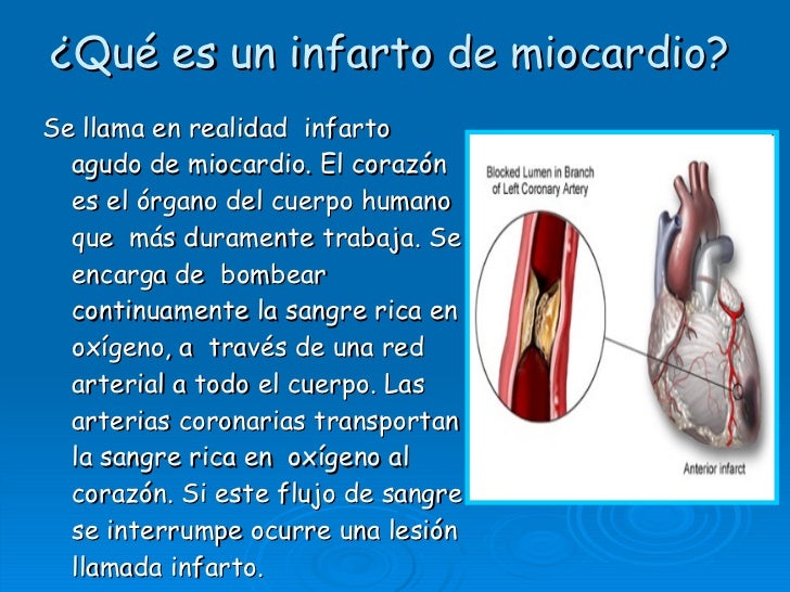 Image result for que es un infarto al miocardio