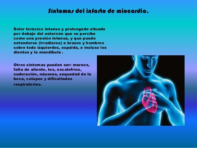 ¿Cuáles Son Los Síntomas Más Comunes De Un Infarto De Miocardio – WGYL
