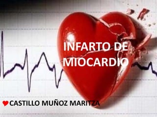INFARTO DE
MIOCARDIO
CASTILLO MUÑOZ MARITZA
 