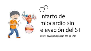 Infarto de
miocardio sin
elevación del ST
KEREN ALVARADO RUANO 200 14 1746
 