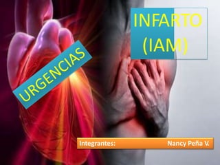 Integrantes: Nancy Peña V.
INFARTO
(IAM)
 