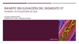 INFARTO SIN ELEVACIÓN DEL SEGMENTO ST
REVISIÓN / ACTUALIZACIÓN DE GUÍA
PALOMA GUERRA BLANCO
RESIDENTE DE 2º AÑO - MEDICINA INTERNA
JUNIO 2019
 