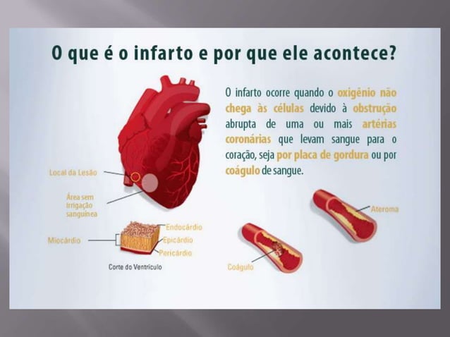 Infarto Sintomas e Primeiros Socorros | PPTX