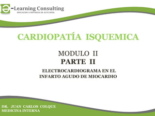 MODULO II
PARTE II
ELECTROCARDIOGRAMA EN EL
INFARTO AGUDO DE MIOCARDIO
DR. JUAN CARLOS COLQUE
MEDICINA INTERNA
 