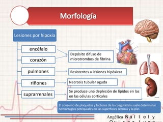 Lesiones por hipoxia

       encéfalo
                               Depósito difuso de
       corazón                 microtrombos de fibrina


      pulmones                 Resistentes a lesiones hipóxicas

        riñones               Necrosis tubular aguda

                              Se produce una depleción de lípidos en las
    suprarrenales             en las células corticales

                       El consumo de plaquetas y factores de la coagulación suele determinar
                       hemorragias petequiales en las superficies serosas y la piel.

                                                        Angélica N a l l e l y
 