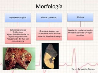 Morfología
   Rojos (Hemorrágico)              Blancos (Anémicos)                    Sépticos




     Oclusiones venosas                                         Vegetación cardiaca emboliza
                                   Oclusión a órganos con
        Tejidos laxos                                           Microbios colonizar un tejido
                                circulación arterial terminal
Tejidos de doble circulación                                             necrótico
  Tejidos congestionados       Limitación de salida de sangre
 Recuperación del flujo con
       necrosis previa




                                                                    Yarely Respardo Gamez
 