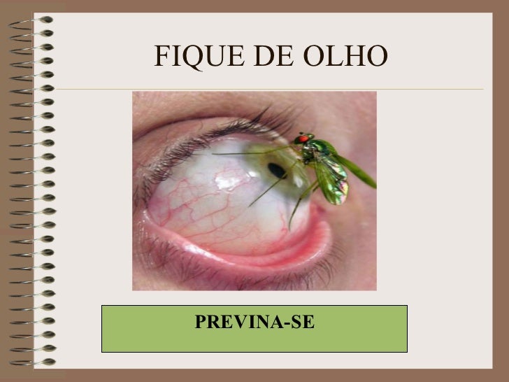 As dobras em volta de olhos sobre o que fala