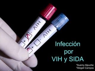 Infección
por
VIH y SIDA
*Suemy Alpuche
*Abigail Campos
 