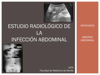 ESTUDIO RADIOLÓGICO DE
LA
INFECCIÓN ABDOMINAL

JATD
Facultad de Medicina de Sevilla

PERITONITIS

ABSCESO
ABDOMINAL

 