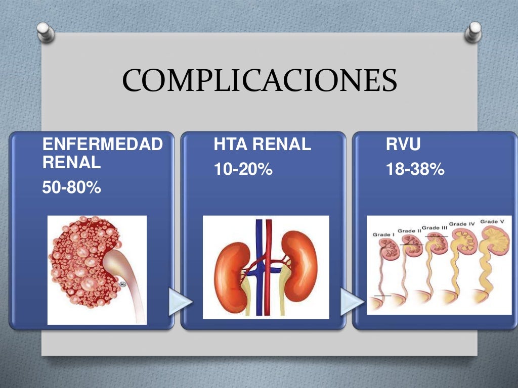 Infección de vias urinarias en pediatria Infección de vias urinarias en pediatria