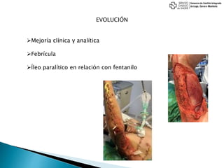 EVOLUCIÓN
Mejoría clínica y analítica
Febrícula
Íleo paralítico en relación con fentanilo
 