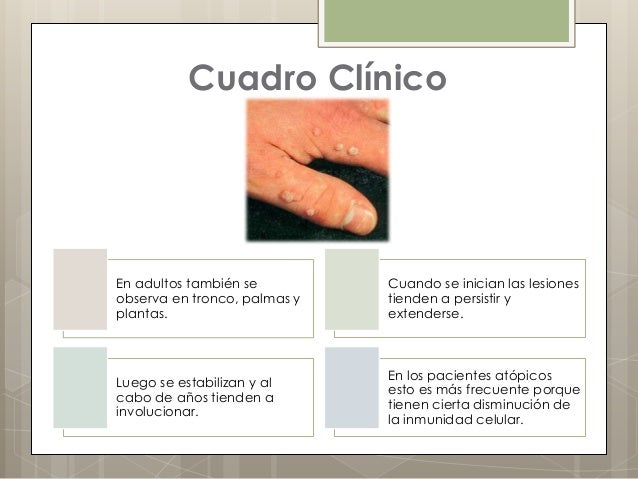 El menú para el niño de 7 meses con atopicheskim por la dermatitis