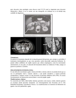 para descartar otras patologías como absceso renal. El US renal es importante para descartar
obstrucción o litiasis si no se cuenta con una tomografía, sin embargo no es un método muy
confiable de diagnóstico.
Tratamiento:
En general el tratamiento depende de la situación general del paciente, pero siempre es preferible el
tratamiento intrahospitalario, ya que estos pacientes suelen desarrollar septicemia fácilmente. Se
pueden utilizar antibióticos de amplio espectro que cubran uropatogenos, como los mencionados
anteriormente en esta guía, y la duración del tratamiento deberá ser mínimo de 10 días, aunque en
general se prefieren 2 semanas.
PIELONEFRITIS ENFISEMATOSA
Es una infección necrotizante aguda e intensa del riñón y sistema colector con producción de gas ya
sea en parénquima renal o sistema colector, y que puede extenderse a espacio perirenal,
retroperitoneo y órganos vecinos. Es más frecuente en pacientes diabéticos (80 a 90%). Se asocia
frecuentemente con obstrucción ureteral, litiasis o necrosis papilar aguda.
Manifestaciones clínicas:
Se caracteriza por fiebre, dolor lumbar síntomas generales como nausea, vomito, malestar general,
en ocasiones puede presentar neumaturia. Los microorganismos más frecuentes son E. Coli,
Klebsiella Pneumoniae, Esterobacter Cloacae. Las manifestaciones en exámenes de laboratorio son
iguales a las de la pielonefritis aguda.
 
