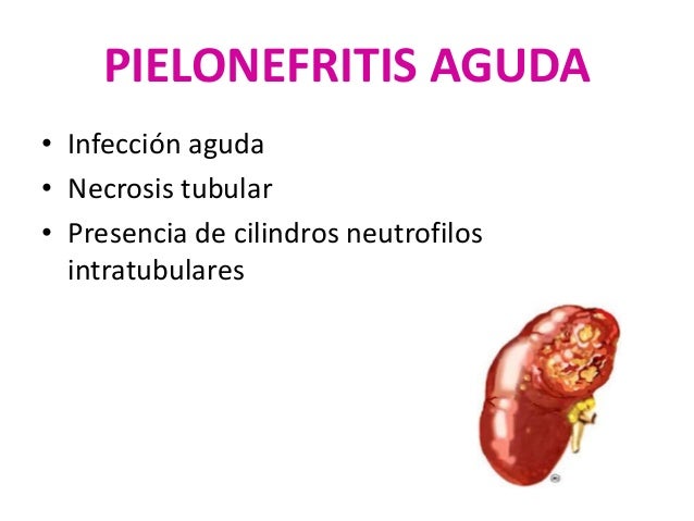 Sheynyy la osteocondrosis puesto en marcha los síntomas y el tratamiento