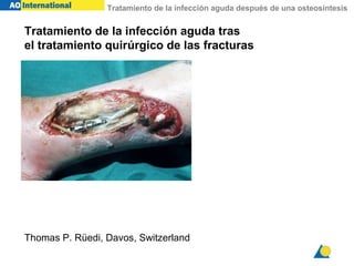 Tratamiento de la infección aguda después de una osteosíntesis
Tratamiento de la infección aguda tras
el tratamiento quirúrgico de las fracturas
Thomas P. Rüedi, Davos, Switzerland
 