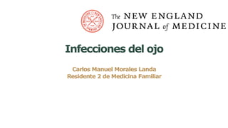 Carlos Manuel Morales Landa
Residente 2 de Medicina Familiar
Infecciones del ojo
 