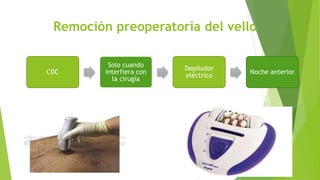 Remoción preoperatoria del vello
CDC
Solo cuando
interfiera con
la cirugía
Depilador
eléctrico
Noche anterior
 