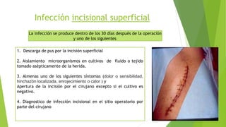 Infección incisional superficial
La infección se produce dentro de los 30 días después de la operación
y uno de los siguientes:
1. Descarga de pus por la incisión superficial
2. Aislamiento microorganismos en cultivos de fluido o tejido
tomado asépticamente de la herida.
3. Almenas uno de los siguientes síntomas (dolor o sensibilidad,
hinchazón localizada, enrojecimiento o calor ) y
Apertura de la incisión por el cirujano excepto si el cultivo es
negativo.
4. Diagnostico de infección incisional en el sitio operatorio por
parte del cirujano
 