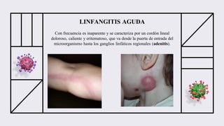Linfangitis Reticular Infeccion de tejidos blandos, Celulitis, Erisipela y Linfangitis ...