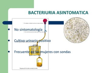BACTERIURIA ASINTOMATICA No sintomatología  Cultivo urinario positivo  Frecuente en las mujeres con sondas 